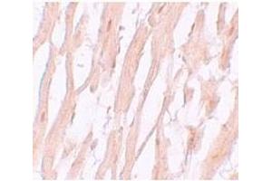 Immunohistochemistry of ATG9A in human heart tissue with ATG9A antibody at 5 μg/mL. (ATG9A 抗体  (C-Term))