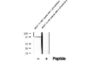 Western blot analysis of extracts of MOLT-15 cells treated with phosphatase, using Phospho-LCP1 (Tyr28) Antibody.