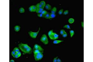 Immunofluorescence (IF) image for anti-ATPase, H+ Transporting, Lysosomal 14kDa, V1 Subunit F (ATP6V1F) (AA 1-119) antibody (ABIN7175258)