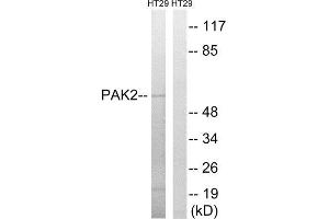Western Blotting (WB) image for anti-P21-Activated Kinase 2 (PAK2) (Ser62) antibody (ABIN1848252) (PAK2 抗体  (Ser62))