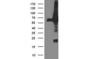 Western Blotting (WB) image for anti-Dipeptidyl-Peptidase 3 (DPP3) antibody (ABIN1497831) (DPP3 抗体)