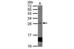 Image no. 1 for anti-Cytoglobin (CYGB) (AA 1-190) antibody (ABIN1501883) (CYGB 抗体  (AA 1-190))