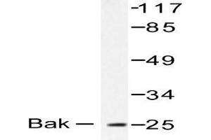 Image no. 1 for anti-BCL2-Antagonist/killer 1 (BAK1) antibody (ABIN265324) (BAK1 抗体)