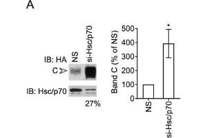 Hsc70/Hsp70 suppresses levels of mature CFTR. (HSP70/HSC70 抗体)