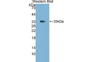 Detection of Recombinant FGg, Cattle using Polyclonal Antibody to Fibrinogen Gamma (FGg) (FGG 抗体  (AA 168-444))