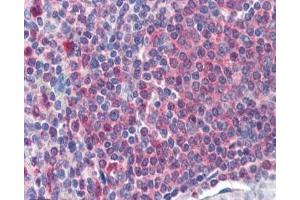 IHC staining of FFPE human spleen with Catalase antibody at 2ug/ml. (Catalase 抗体)