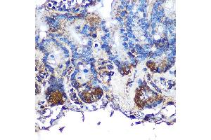 Immunohistochemistry of paraffin-embedded mouse intestin using ITLN1 Rabbit pAb (ABIN6132446, ABIN6142601, ABIN6142602 and ABIN6223070) at dilution of 1:100 (40x lens). (ITLN1/Omentin 抗体  (AA 19-313))