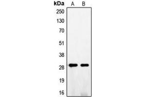 Western blot analysis of FGF5 expression in A375 (A), NIH3T3 (B) whole cell lysates. (FGF5 抗体  (C-Term))