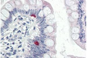 Human Small Intestine (formalin-fixed, paraffin-embedded) stained with COPA antibody ABIN337288 at 5 ug/ml followed by biotinylated goat anti-rabbit IgG secondary antibody ABIN481713, alkaline phosphatase-streptavidin and chromogen. (COPA 抗体  (AA 1-19))