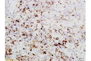 Formalin-fixed and paraffin embedded mouse lung labeled with Rabbit Anti PRAME Polyclonal Antibody, Unconjugated  at 1:200 followed by conjugation to the secondary antibody and DAB staining