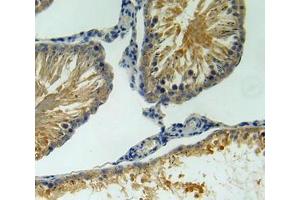 IHC-P analysis of testis tissue, with DAB staining.