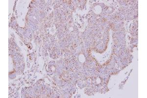Immunohistochemistry (IHC) image for anti-NADH Dehydrogenase (Ubiquinone) Fe-S Protein 1, 75kDa (NADH-Coenzyme Q Reductase) (NDUFS1) (Center) antibody (ABIN2856931)
