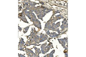 IHC analysis of BubR1/BUB1B using anti-BubR1/BUB1B antibody (ABIN7600960). (BUB1B 抗体  (AA 26-448))