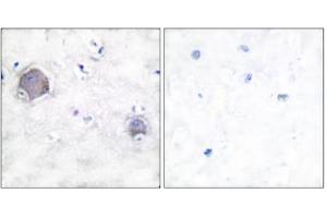 Immunohistochemical analysis of paraffin-embedded human brain tissue, using Notch 1 (cleaved-Val1744) antibody. (Notch1 抗体  (Cleaved-Val1754, Internal Region))