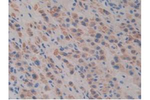 IHC-P analysis of Mouse Liver Tissue, with DAB staining. (SLIT1 抗体  (AA 603-773))