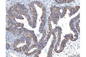 IHC analysis of Poliovirus Receptor/PVR using anti-Poliovirus Receptor/PVR antibody (ABIN7601071).