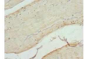 Immunohistochemistry of paraffin-embedded human skeletal muscle tissue using ABIN7148048 at dilution of 1:100 (Cofilin 2 抗体  (AA 1-166))