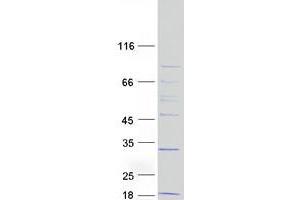 MRPL43 Protein (Transcript Variant 2) (Myc-DYKDDDDK Tag)