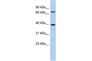 WB Suggested Anti-NYD-SP21 Antibody Titration:  0. (MS4A14 抗体  (Middle Region))