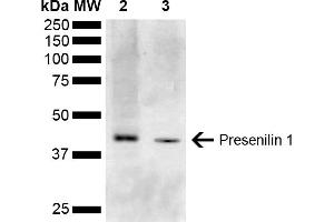Western blot analysis of Mouse Kidney, Liver showing detection of ~52. (Presenilin 1 抗体  (AA 1-100) (HRP))