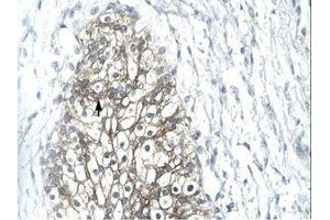 Image no. 1 for anti-Matrix Metallopeptidase 19 (MMP19) (AA 349-398) antibody (ABIN202685) (MMP19 抗体  (AA 349-398))