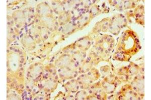 Immunohistochemistry of paraffin-embedded human pancreatic tissue using ABIN7144328 at dilution of 1:100 (TAP1 抗体  (AA 524-808))