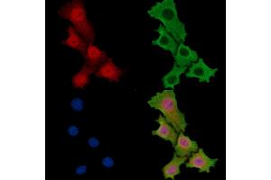 DHX32 Antibody staining HepG2 cells by IF/ICC. (DHX32 抗体)
