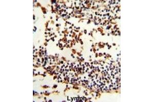 Immunohistochemistry (IHC) image for anti-Immunoglobulin Heavy Constant alpha 1 (IGHA1) antibody (ABIN3003223) (IGHA1 抗体)