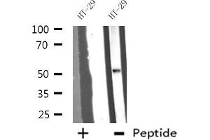 Western blot analysis of extracts from HT-29 cells, using DDX19B antibody. (DDX19B 抗体  (N-Term))