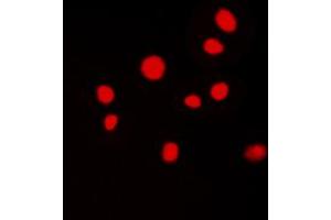 Immunofluorescent analysis of ATRIP staining in MCF7 cells. (ATRIP 抗体  (N-Term))