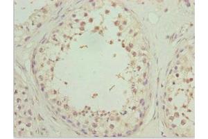 Immunohistochemistry of paraffin-embedded human testis tissue using ABIN7176149 at dilution of 1:100 (ZNF2 抗体  (AA 1-200))