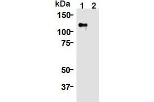 Western Blotting (WB) image for anti-Kinesin Family Member 11 (KIF11) (AA 1-1056), (N-Term) antibody (ABIN1449288) (KIF11 抗体  (N-Term))