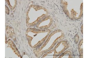 Immunoperoxidase of monoclonal antibody to TUBA1B on formalin-fixed paraffin-embedded human prostate. (TUBA1B 抗体  (AA 1-451))