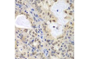 Immunohistochemistry (Paraffin-embedded Sections) (IHC (p)) image for anti-Minichromosome Maintenance Complex Component 3 (MCM3) (AA 1-295) antibody (ABIN3021327)