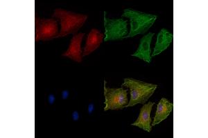 Phospho-IP3 Receptor (Ser1764) Antibody staining A549 cells(heat shock treatment) by IF/ICC. (IP3 Receptor 抗体  (pSer1764))