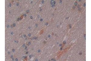 DAB staining on IHC-P; Samples: Human Cerebrum Tissue (Osteopontin 抗体  (AA 18-314))