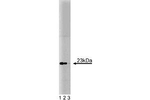 Western blot analysis of Bad on an A431 cell lysate (Human epithelial carcinoma, ATCC CRL-1555). (BAD 抗体  (AA 39-198))