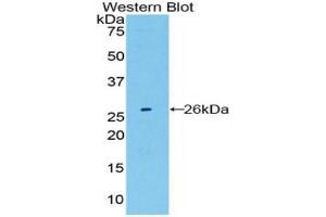 Western Blotting (WB) image for anti-Proteasome (Prosome, Macropain) Subunit, beta Type, 8 (Large Multifunctional Peptidase 7) (PSMB8) (AA 75-272) antibody (ABIN7440308)