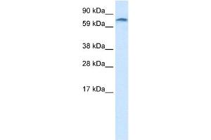 WB Suggested Anti-ZNF84 Antibody Titration:  1. (ZNF84 抗体  (C-Term))