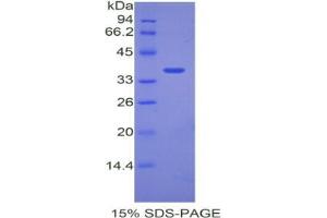 SDS-PAGE analysis of Mouse ANGPTL7 Protein. (ANGPTL7 蛋白)