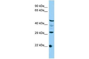 Host: Rabbit Target Name: C3orf26 Sample Type: HepG2 Whole Cell lysates Antibody Dilution: 1. (CMSS1 抗体  (N-Term))
