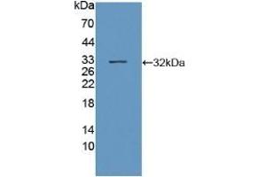 Detection of Recombinant SIRT3, Human using Polyclonal Antibody to Sirtuin 3 (SIRT3) (SIRT3 抗体  (AA 126-399))