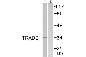Western blot analysis of extracts from COS7 cells, using TRADD antibody.