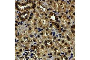 Immunohistochemical analysis of HCCR-1 staining in human kidney formalin fixed paraffin embedded tissue section. (LETMD1 抗体)