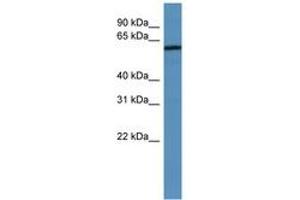 Image no. 1 for anti-Melanoma Antigen Family D, 2 (MAGED2) (AA 67-116) antibody (ABIN6746701) (MAGED2 抗体  (AA 67-116))