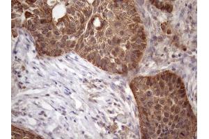 Immunohistochemistry (IHC) image for anti-Amelotin (AMTN) antibody (ABIN2716038) (Amelotin 抗体)