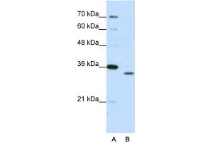 WB Suggested Anti-PSMA1 Antibody Titration:  1. (PSMA1 抗体  (N-Term))