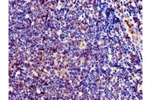 Immunohistochemistry of paraffin-embedded human lymph node tissue using ABIN7147139 at dilution of 1:100 (ITGB1 抗体  (AA 297-380))