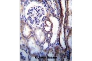 ATP6V1B1 Antibody (Center) (ABIN655485 and ABIN2845006) immunohistochemistry analysis in formalin fixed and paraffin embedded human kidney tissue followed by peroxidase conjugation of the secondary antibody and DAB staining.