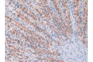 IHC-P analysis of Rat Pancreas Tissue, with DAB staining. (IL1A 抗体)